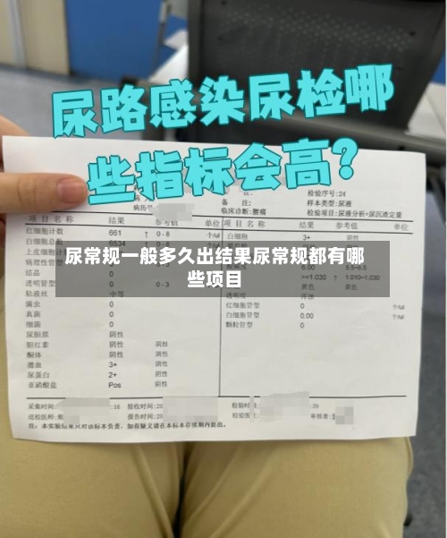 尿常规一般多久出结果尿常规都有哪些项目