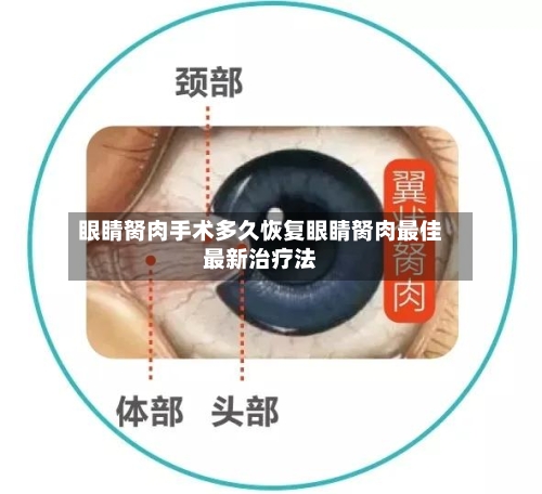 眼睛胬肉手术多久恢复眼睛胬肉最佳最新治疗法
