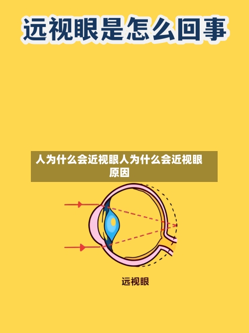 人为什么会近视眼人为什么会近视眼原因