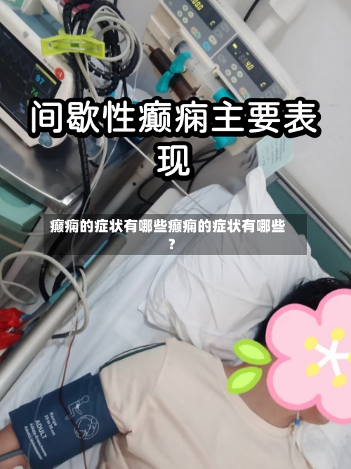 癫痫的症状有哪些癫痫的症状有哪些?